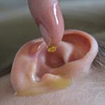 Im Kampf gegen Ohrenverstopfung und Ohrenentzündung